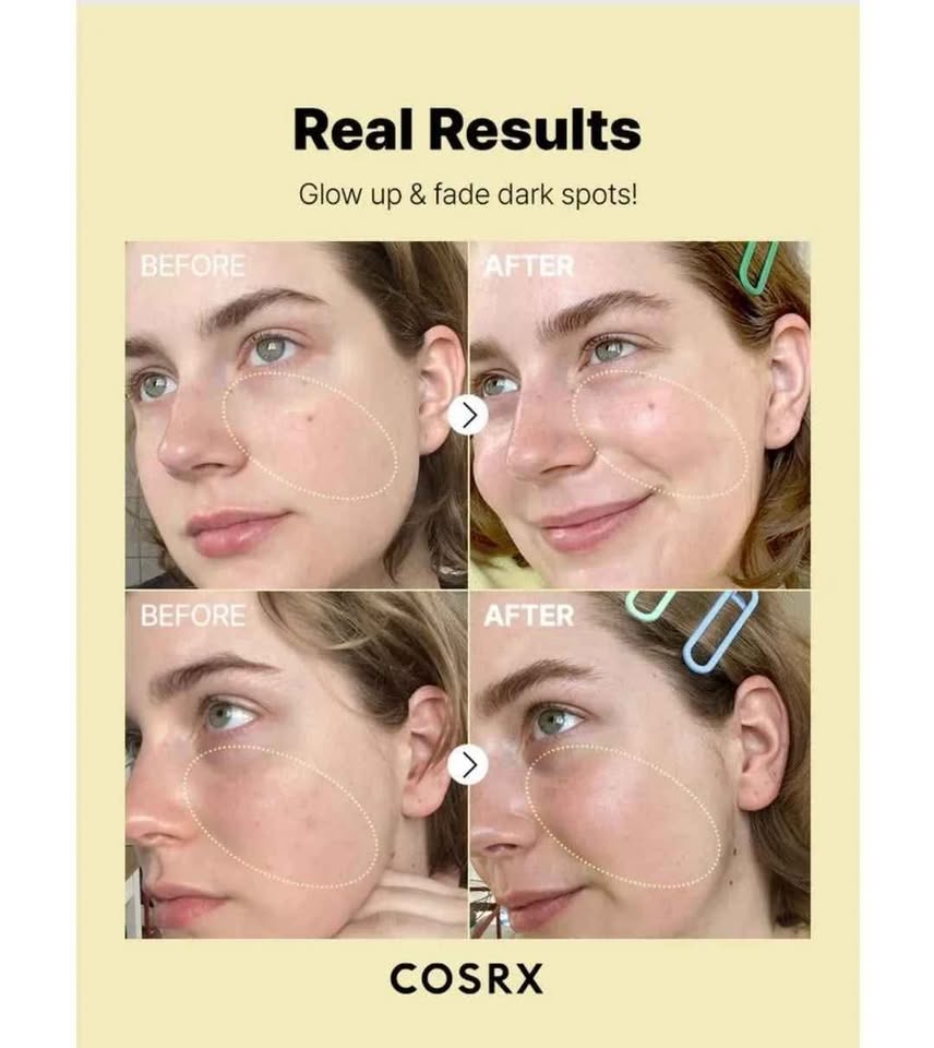 COSRX The Vitamin C 23 Serum — Pure Vitamin C Brightening & Anti-Aging Serum