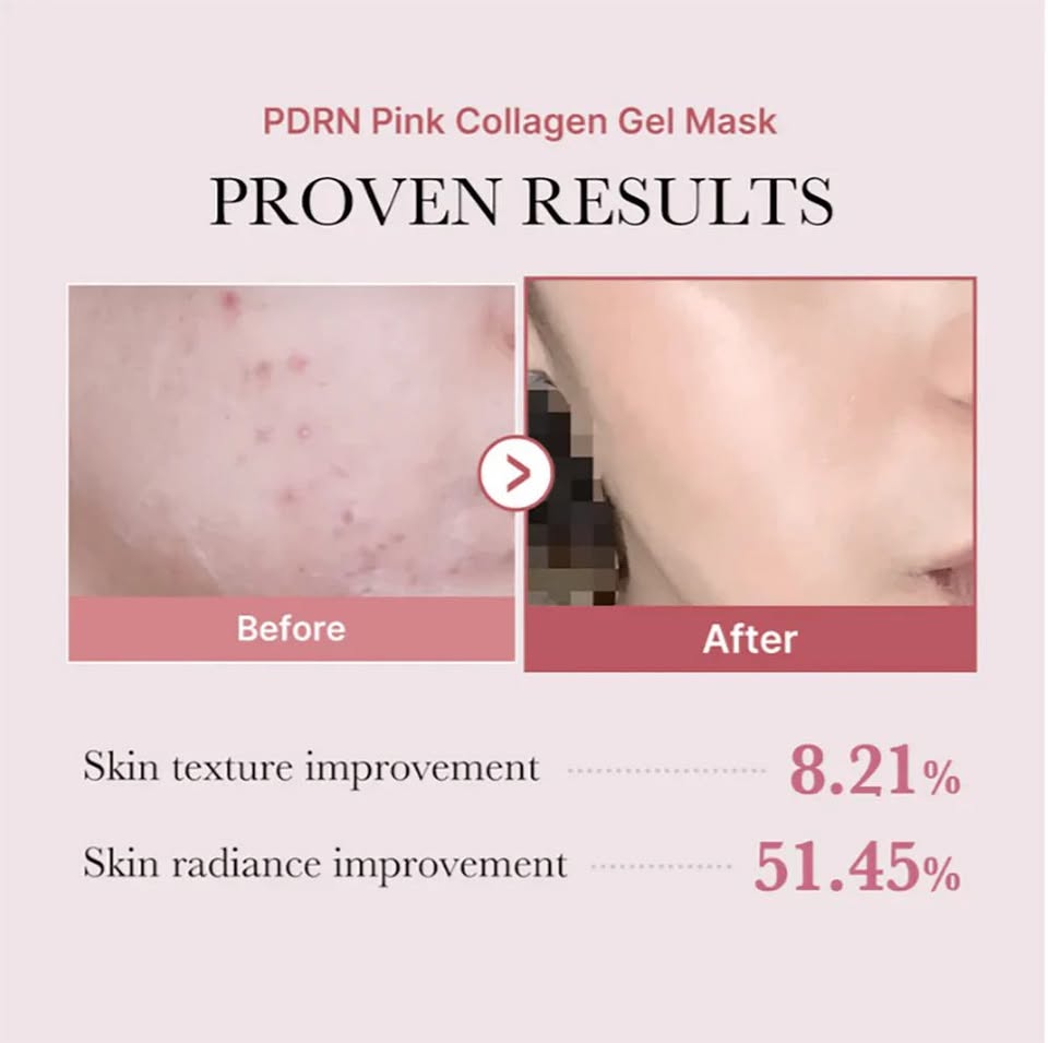 Medicube PDRN Pink Collagen Gel Mask — Regenerating & Firming Hydrogel Mask