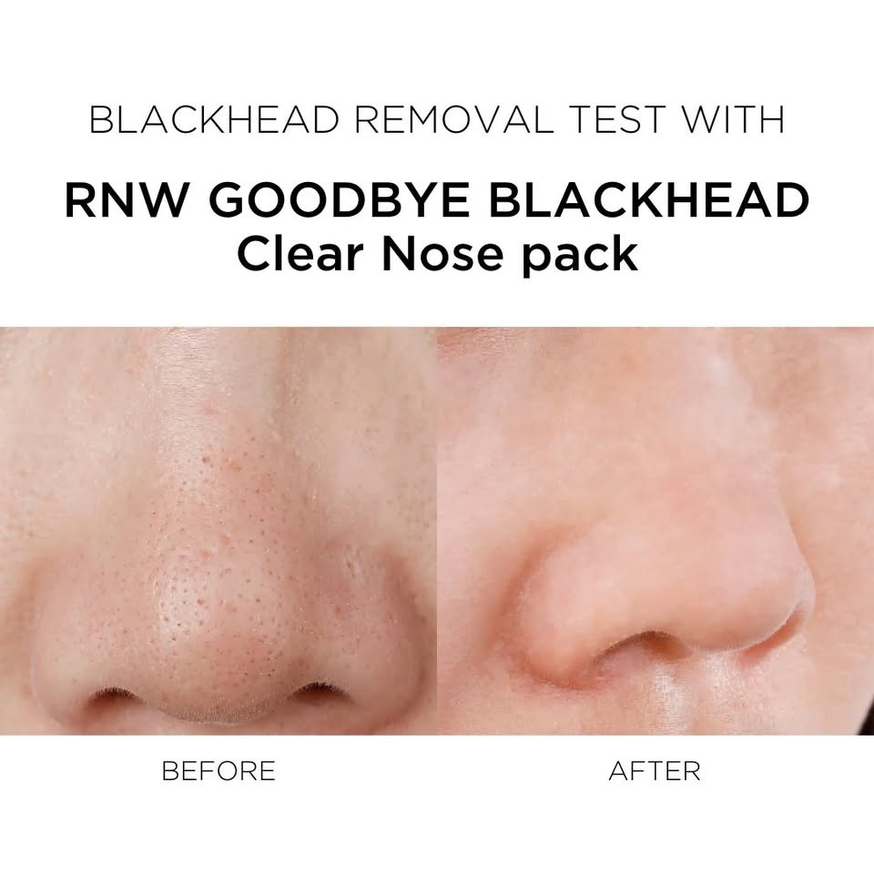 ILSO Natural Mild Clean Nose Patch — Gentle Pore-Clearing & Blackhead Removal Strips