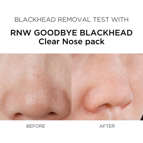 ILSO Natural Mild Clean Nose Patch — Gentle Pore-Clearing & Blackhead Removal Strips