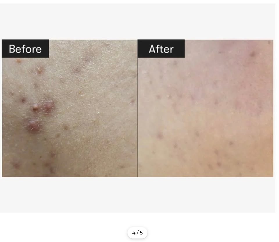 VT Cica Reedle Shot 300 — Intensive Skin Texture Refining & Deep Cica Care